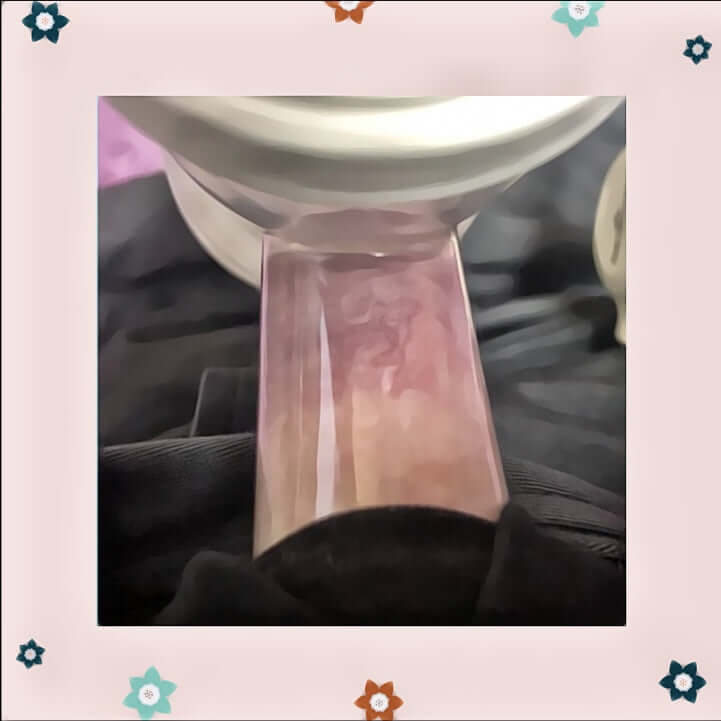 What is an Elastic Nipple?