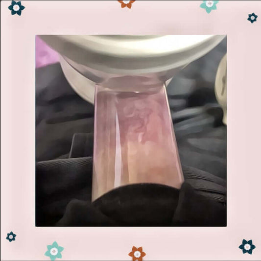 What is an Elastic Nipple?